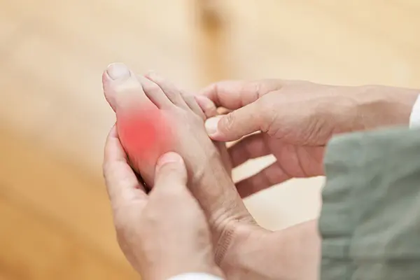 A person with their hands on their right foot. There is redness around the joint of the big toe, depicting swelling and pain from gout. 