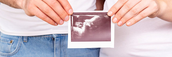 Mann und Frau stehen nebeneinander. Sie halten gemeinsam ein Ultraschallbild hoch.