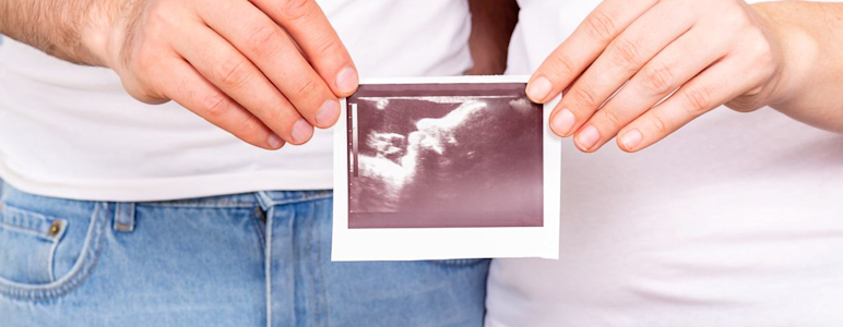 Mann und Frau stehen nebeneinander. Sie halten gemeinsam ein Ultraschallbild hoch.