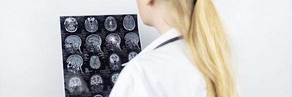 Ärztin begutachtet MRT Bilder eines Patienten mit Multipler Sklerose.