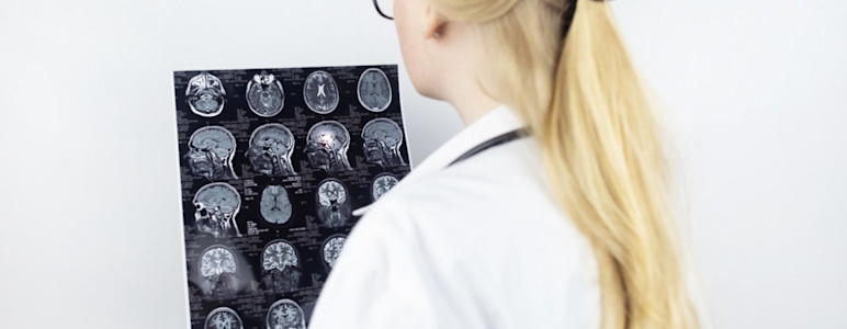 Ärztin begutachtet MRT Bilder eines Patienten mit Multipler Sklerose.