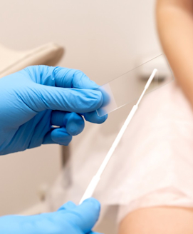 Chlamydien-Test