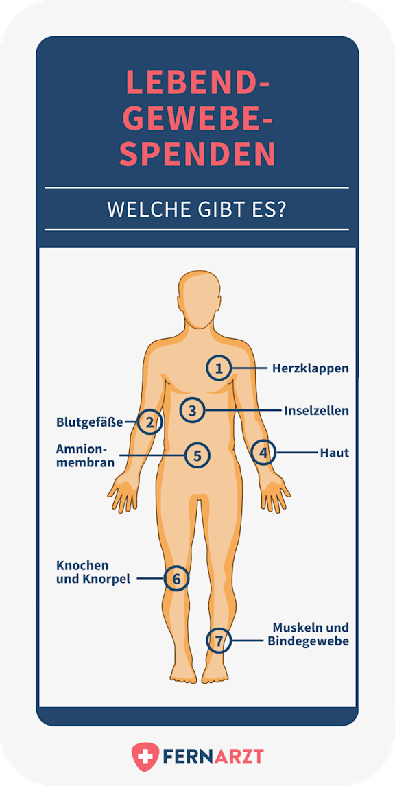 bildliche Darstellung