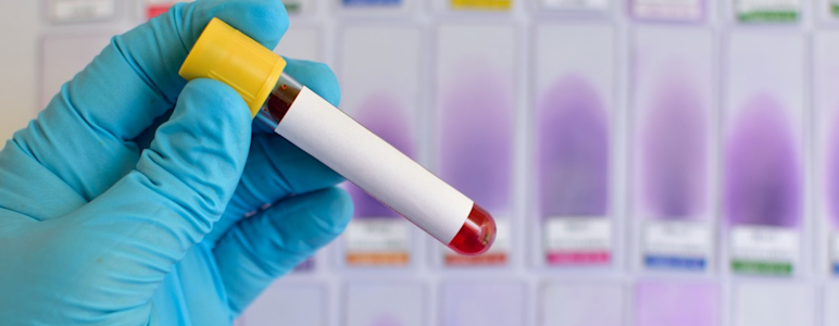 Eine Hand mit einem blauen Handschuh hält eine Blutprobe im Röhrchen.