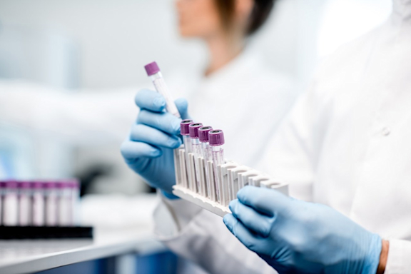 Reagenzgläser und Teströhrchen mit Blut im Labor für Coronatest.