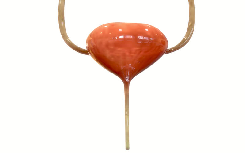 Interstitielle Zystitis (IC)