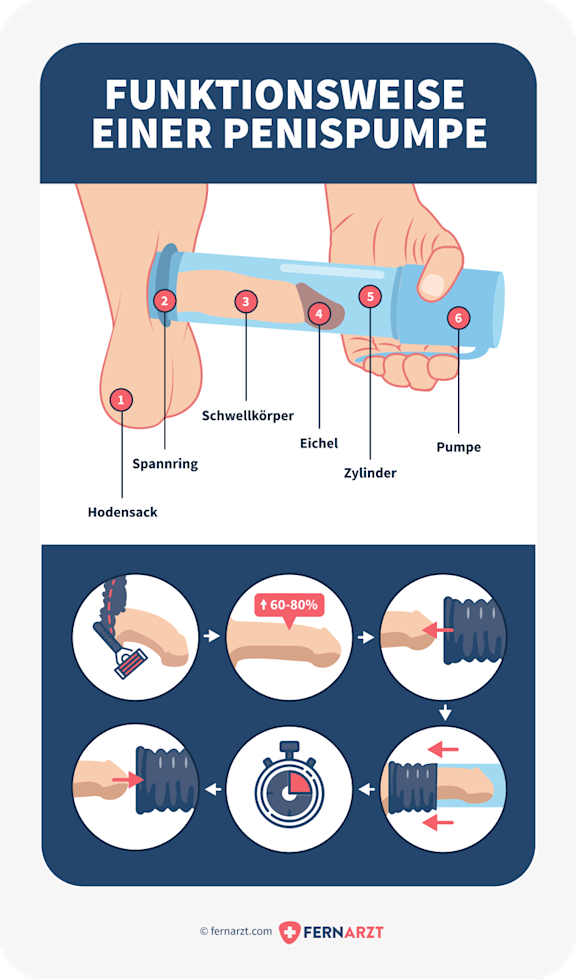 Funktionsweise einer Penispumpe