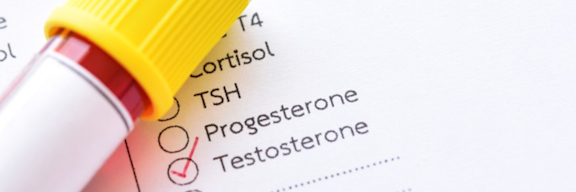 Auf einem Anforderungsschein für das Labor ist der Testosteron-Test ausgewählt.