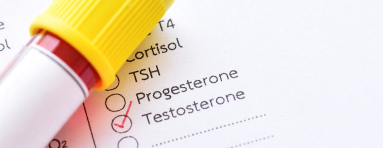 Auf einem Anforderungsschein für das Labor ist der Testosteron-Test ausgewählt.