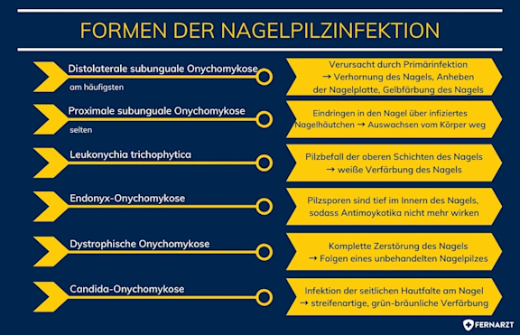 Formen der Nagelpilzinfektion