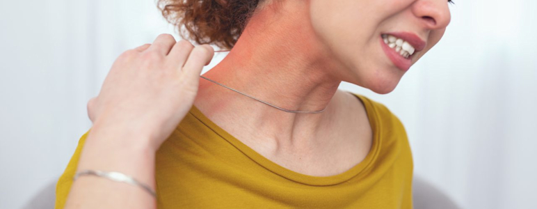 Junge Frau reagiert allergisch auf Kette. Schmuck mit Nickel kann Kontaktekzeme auslösen.