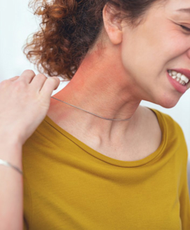 Allergisches Ekzem (Kontaktekzem)