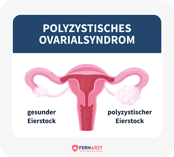 bildliche Darstellung