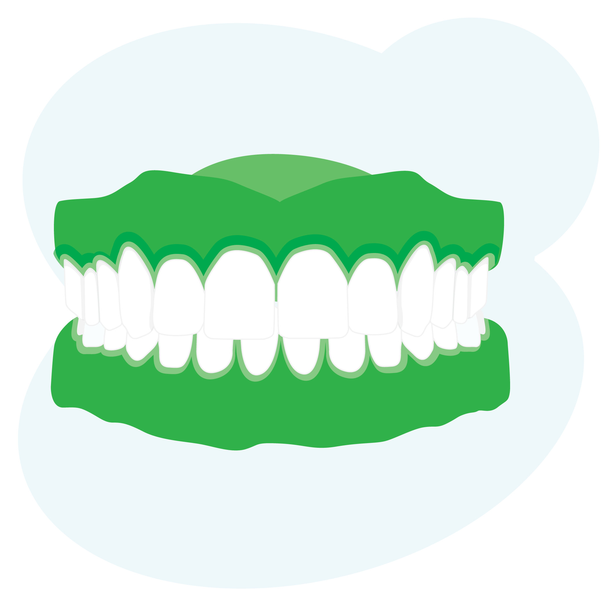 Illustration of teeth in green gums - teeth are clenching