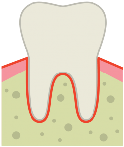 Graphic of tooth and gum