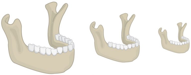 Various sized jaw graphics shrinking from left to right