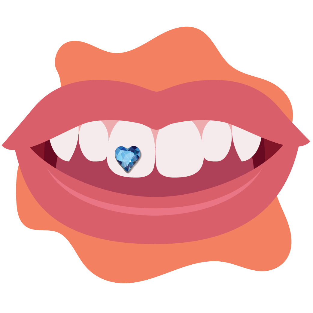 Illustration of a mouth with top row of teeth showing. The front tooth has a blue heart shaped dental gem affixed to it. 
