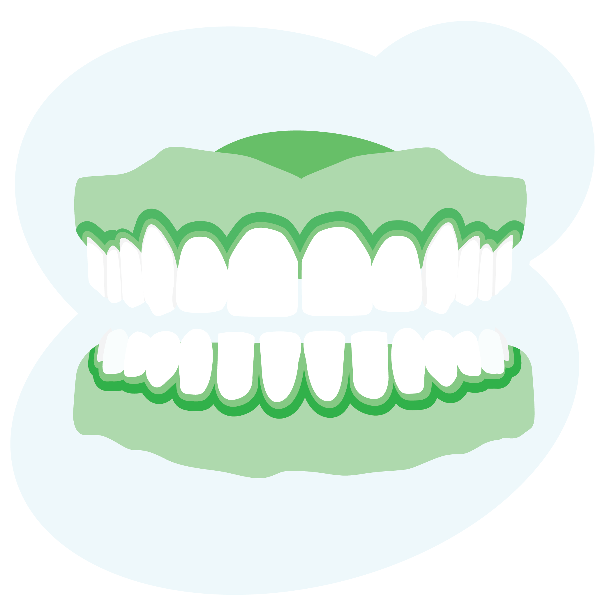 Illustration of a set of dentures, including top and bottom teeth
