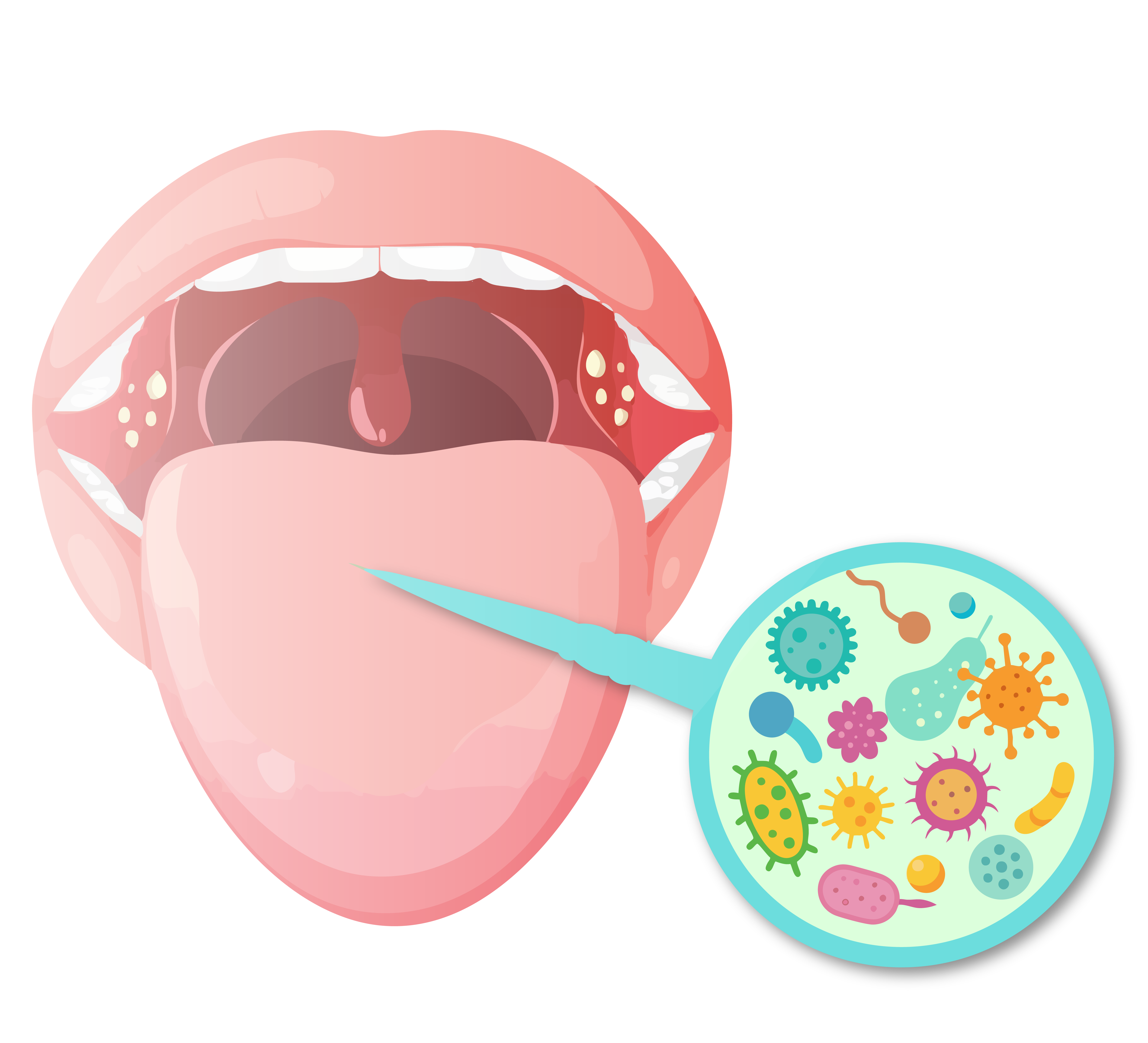 Illustration of an open mouth and tongue with a zoomed in image of microorganisms to represent the makeup of the oral microbiome