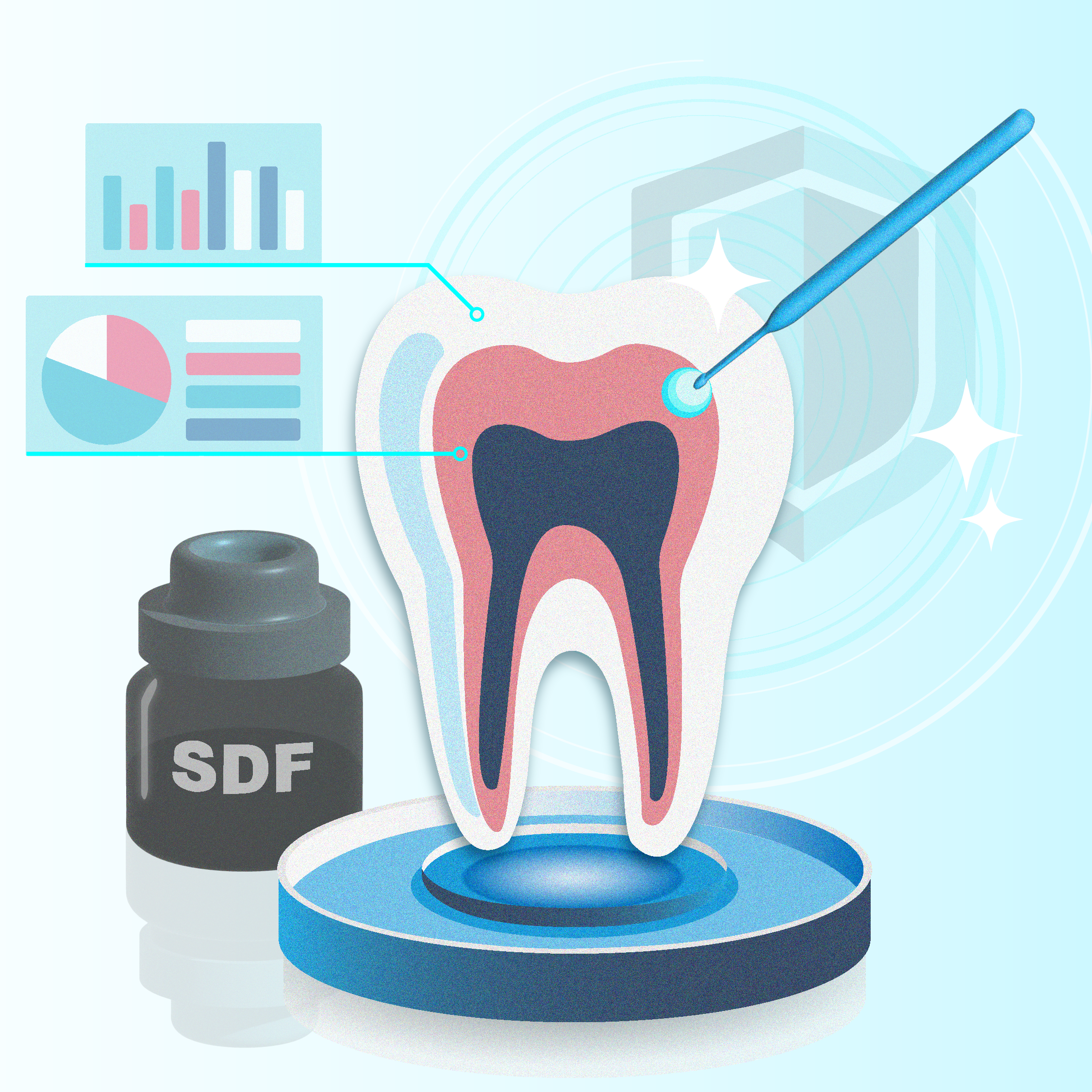 Illustration of a tooth with a bottle and applicator for Silver Diamine Fluoride with SDF being applied to the tooth. 