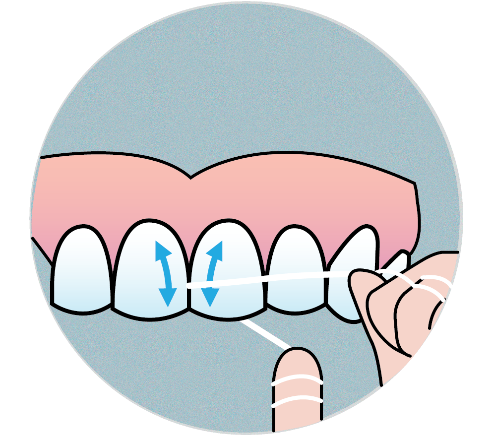 Illustration of dental floss formed into a C-shape and wound between two fingers with arrows pointint up and down on front teeth to show flossing motion. 