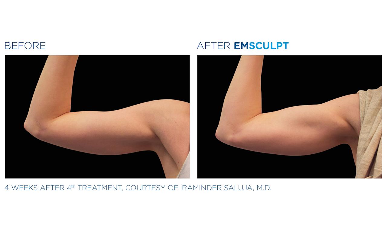 justbobbi_Diary_Emsculpt_02