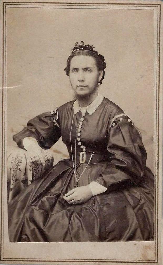 bearded lady - amanda king