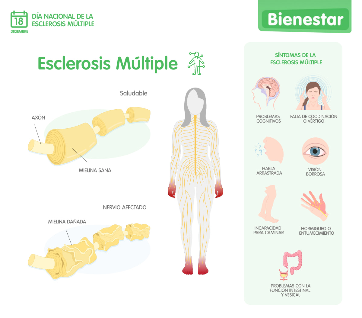 que es la esclororis multiple infografia