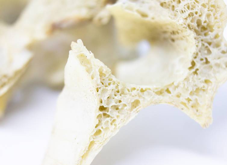 9-CausasDeLaOsteoporosis--mifarma-blog-body-2