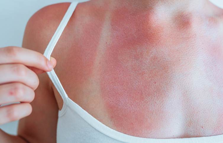 10-protegersedelsol-mifarma-blog-bannerbody-2