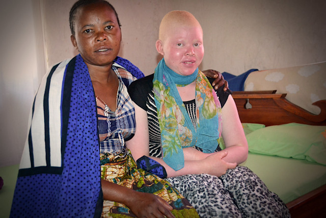 Restoring Hope to a Teenager With Albinism