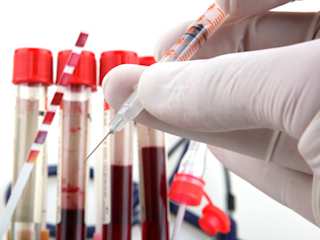 Reagenzgläschen mit Blut