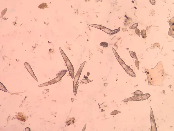 Demodex mites Demodex mites