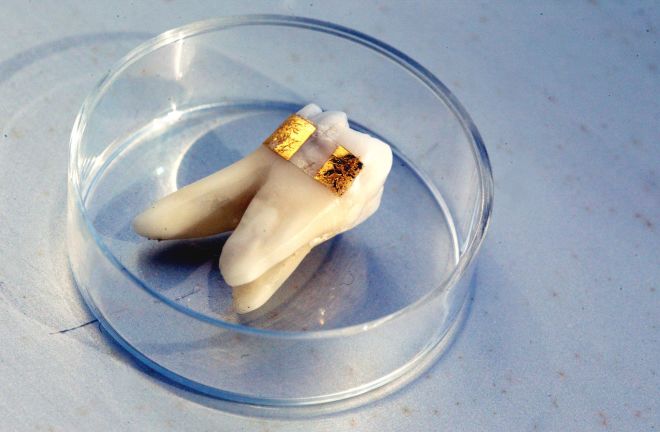 Tooth Tattoo Sensor - AP Photo