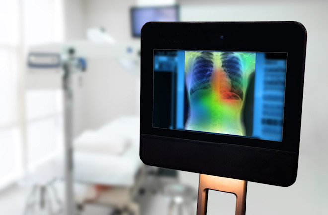 AI Diagnosis Computer Scan COVID-19 - Shutterstock