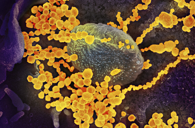SARS CoV-2 (the COVID-19 virus) emerges from the surface of a cell cultured in the lab. (Credit: NIAID/NIH)