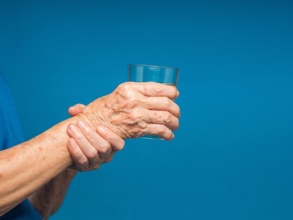 Person struggling to hold a glass showing Parkinson's disease symptoms