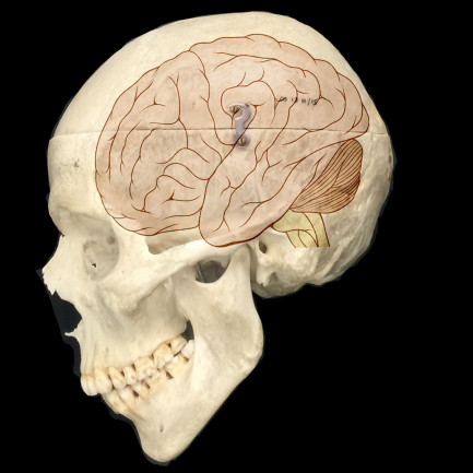 Brain in Skull - Cell