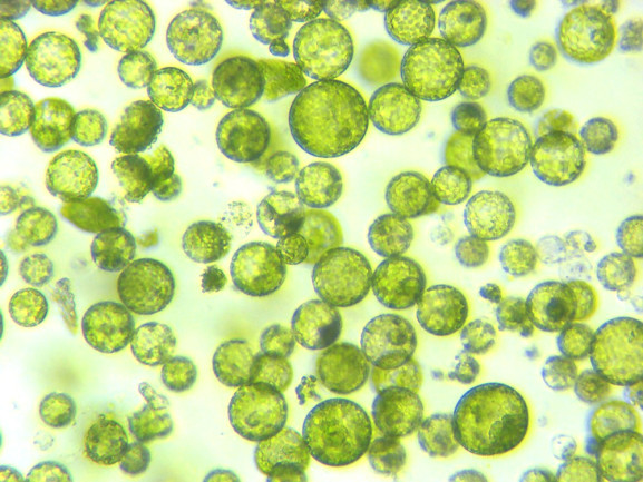 A photomicrograph of a plant protoplast cell isolated for use in a recent cutting-edge biotechnology CRISPR technology experiment.
