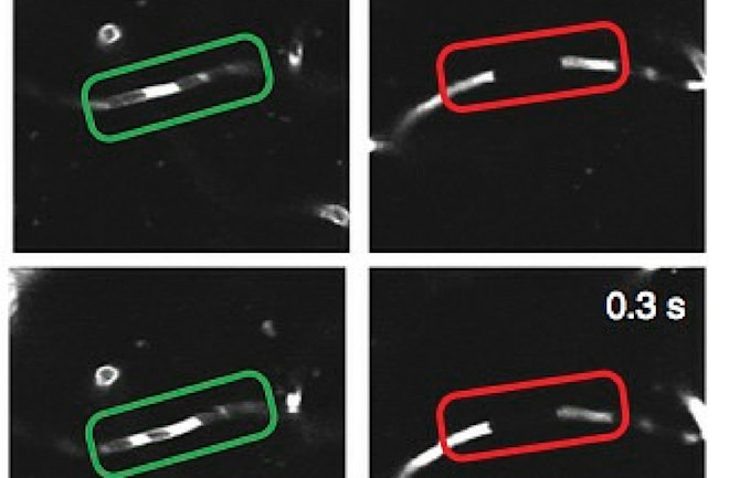 stall catchers blood vessels alzheimer's