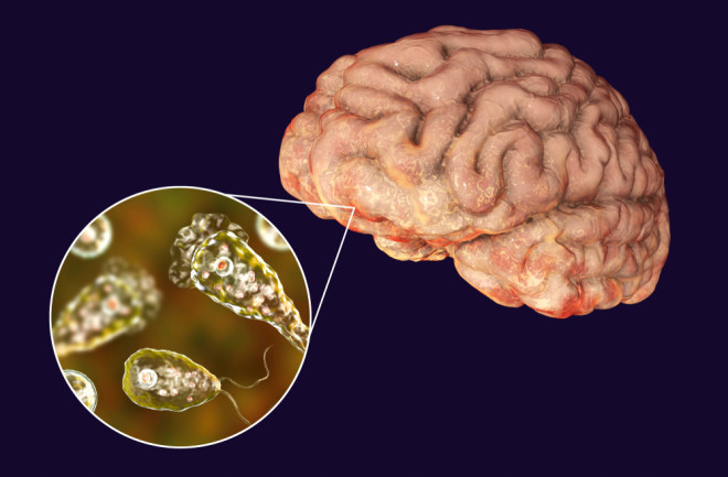 Brain-eating amoeba infection, naegleriasis. Trophozoite form of the parasite Naegleria fowleri 