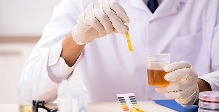 orina-de-un-diabetico-interna-1