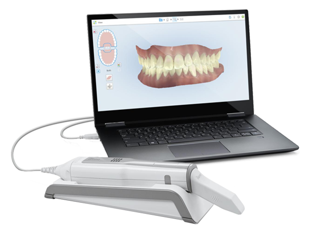 Tero Element® Flex digital scanner