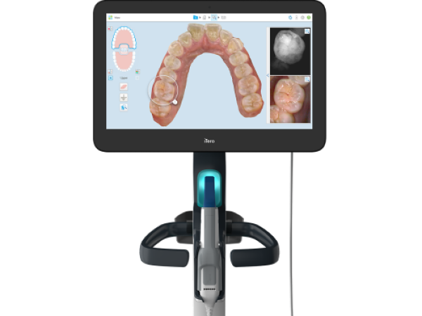 itero scanner