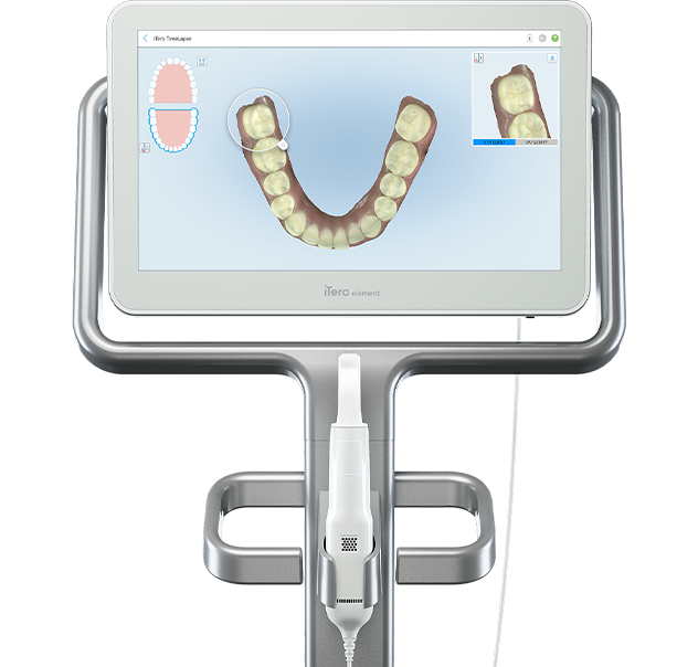 iTero Element 2(R) scanner