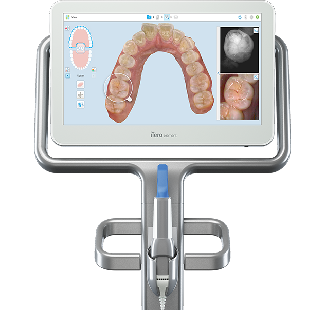 iTero Element® 5D imaging system