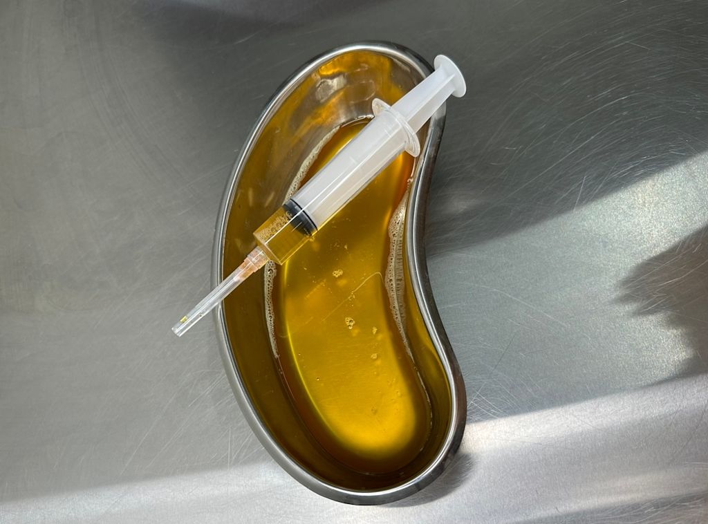 Liquido giallastro denso