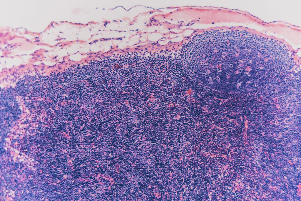 Wichtig: Eine Analyse im Labor