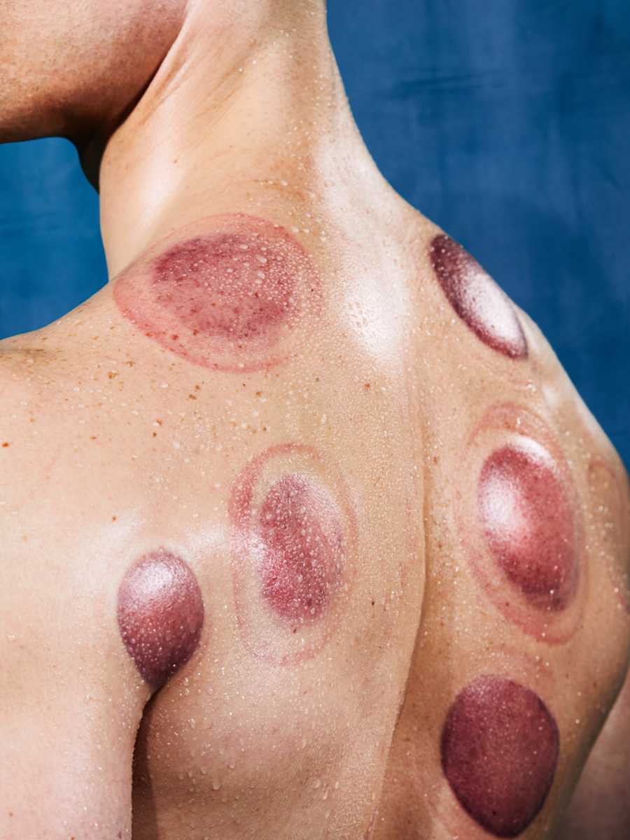 Specialized Recovery