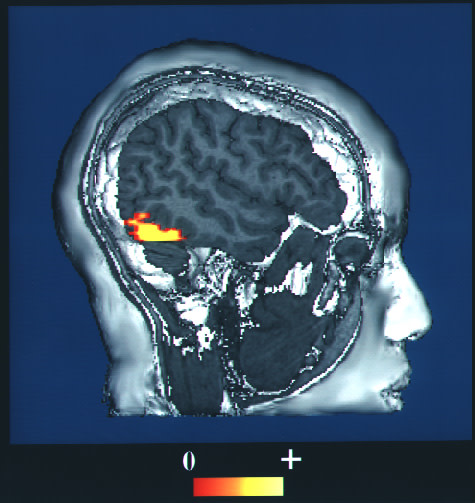 A computer-enhanced fMRI scan of a person who has been asked to look at faces. The predictive science of neurocriminology has attempted to use such scans as a tool for determining psychopathic behavior. Source: National Institutes of Health.